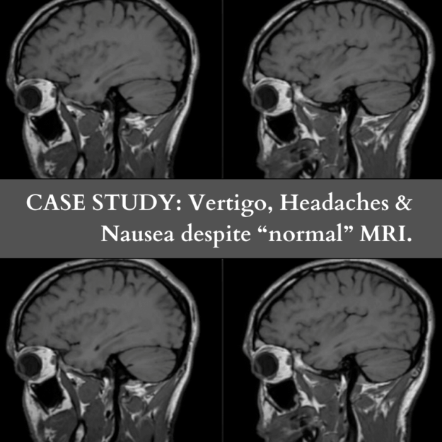 vertigo, headaches, and nausea blog image vertigo, headaches, and nausea blog image