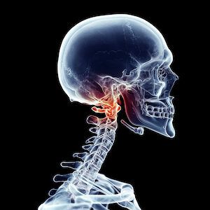 Symptoms of an Atlas Misalignment